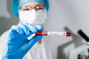 Número de mortes e de novos casos diminuem