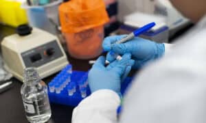 Comissão Europeia financia com 40 ME tratamentos com plasma na UE&nbsp;