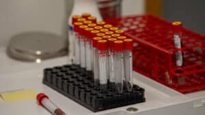 Julho foi o mês com mais testes à Covid-19 em Portugal&nbsp;