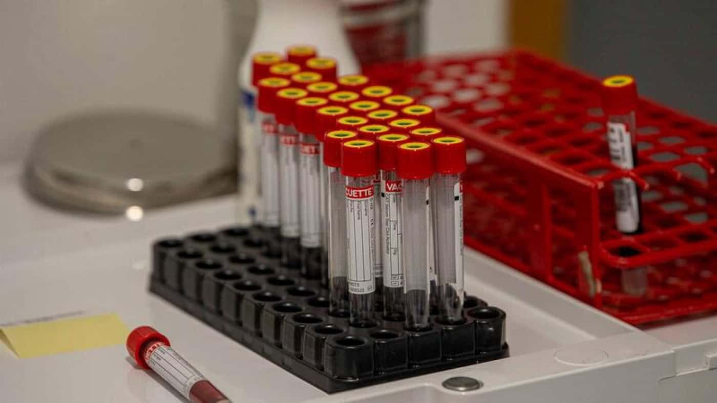 Julho foi o mês com mais testes à Covid-19 em Portugal