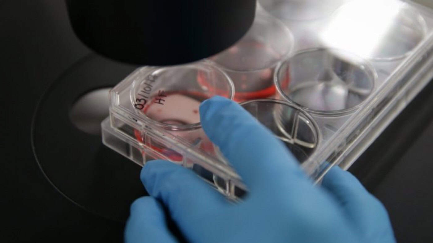 UMinho desenvolve tratamento para o subtipo mais agressivo do cancro da mama