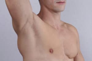 O cancro da mama pela voz de quem vive um dia de cada vez