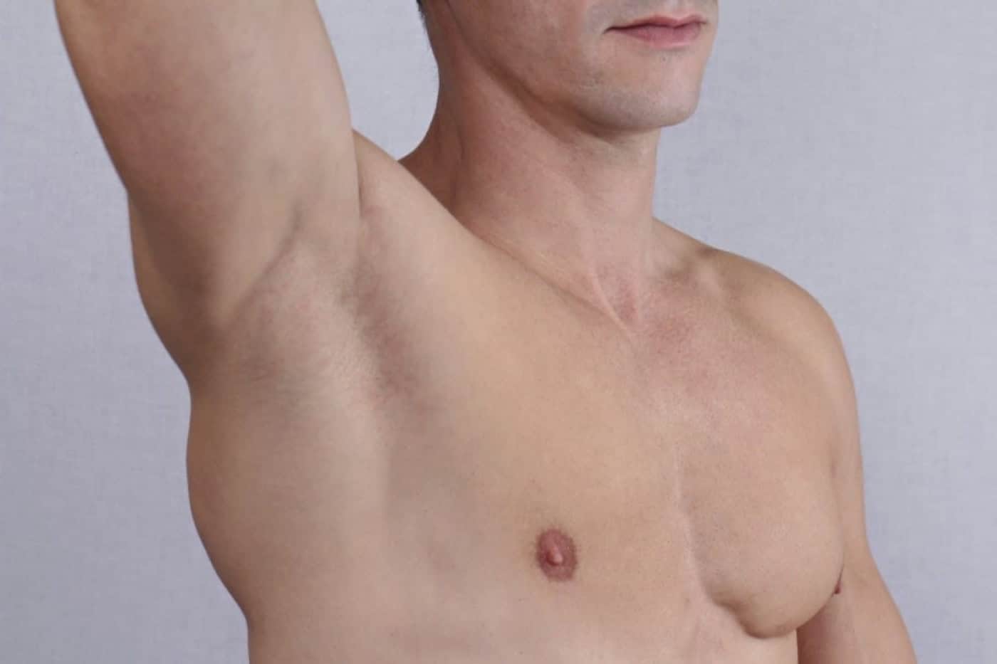 O cancro da mama pela voz de quem vive um dia de cada vez