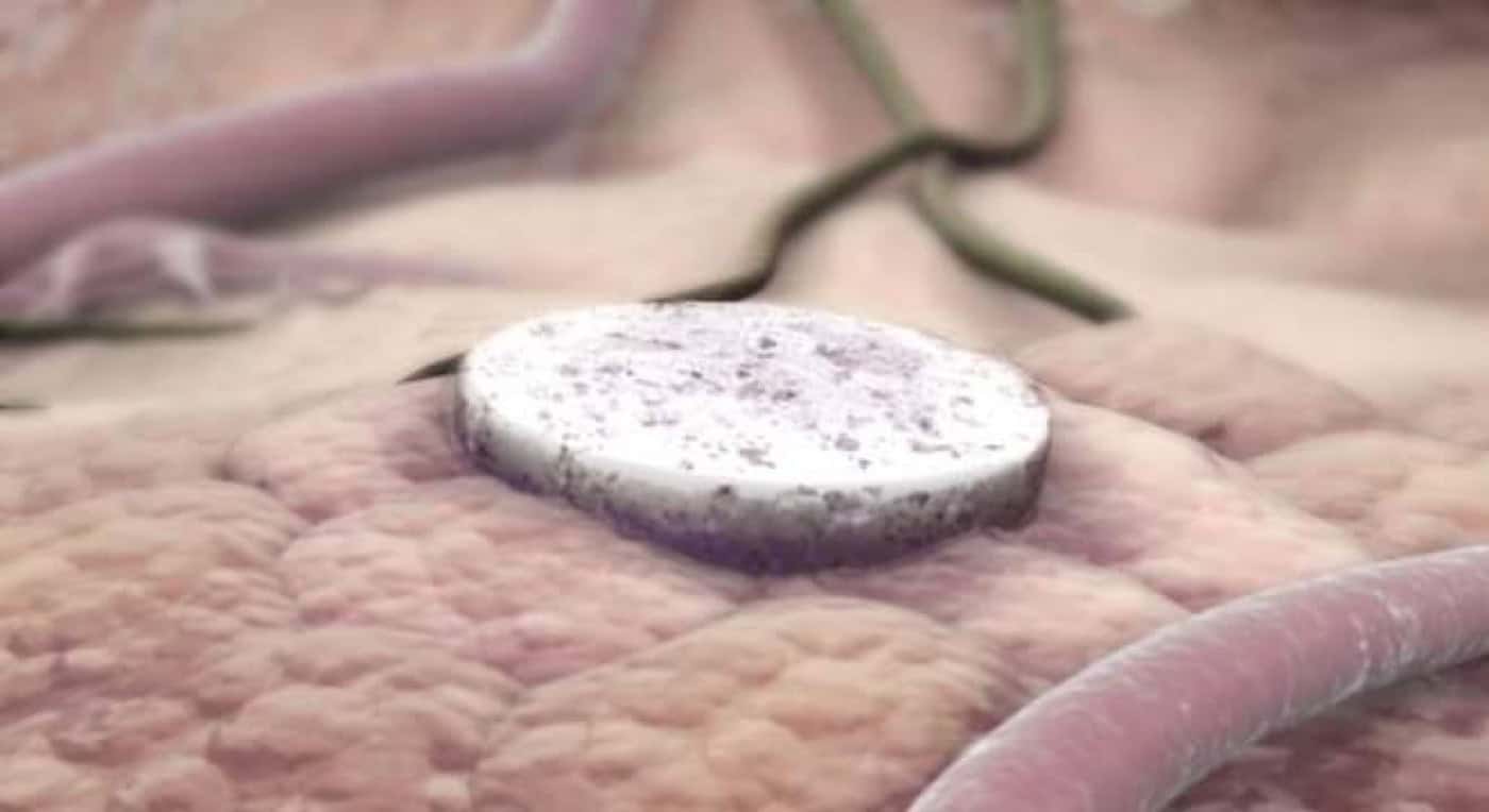 Harvard's Wyss Institute investiga método que reduz o crescimento tumoral