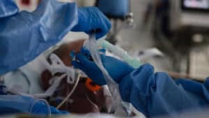 Mais 159 mortes e 10.663 casos de Covid-19 em Portugal