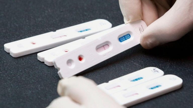 Autorizada venda de autotestes à Covid-19 em farmácias