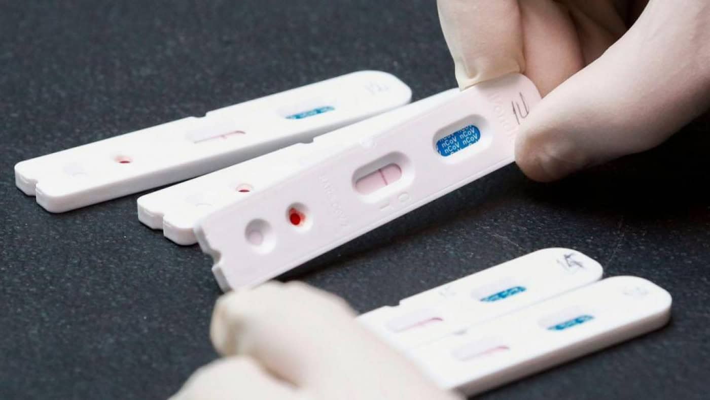 Autorizada venda de autotestes à Covid-19 em farmácias