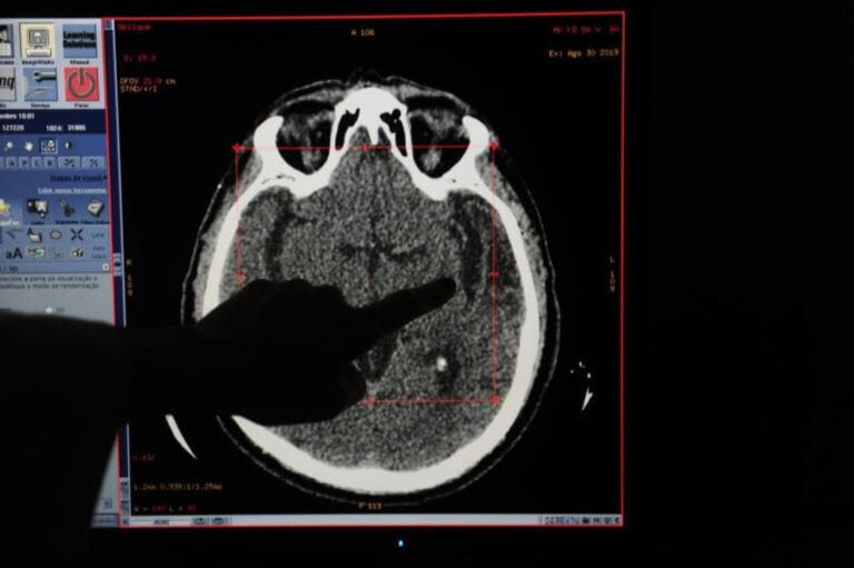 Consultas atrasadas e tratamentos a meio gás aumentam risco de AVC