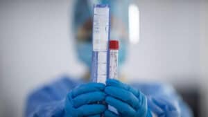 Portugal sem registo de mortes, mas com mais 445 novos casos de covid-19