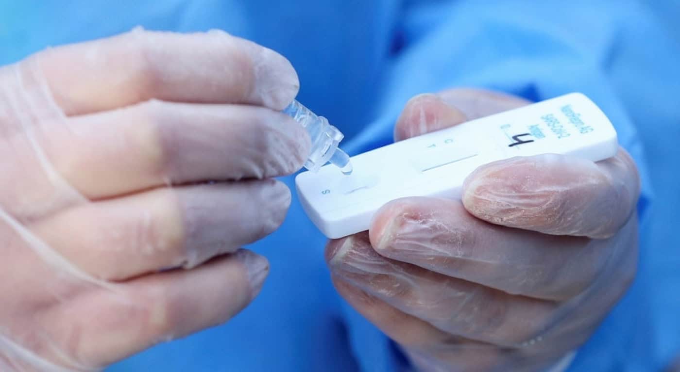 Mais 28 mortes e 13.158 novos casos de Covid em Portugal. Incidência baixa