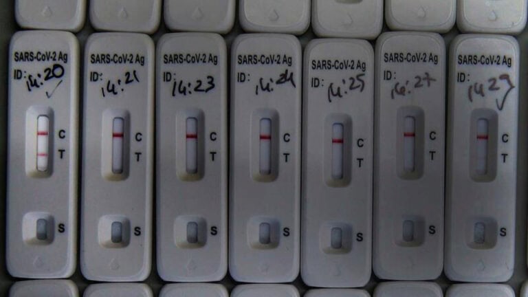 Testes à Covid-19 deixam de ser gratuitos a partir de domingo