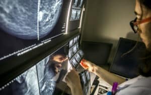 Aumentaram 80% os novos casos de cancro abaixo dos 50 anos desde 1990&nbsp;