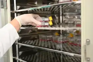 Células estaminais podem ter efeitos terapêuticos no melanoma, revela estudo português&nbsp;