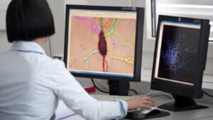 Prémio Bial de Biomedicina 2023 distingue estudo sobre tumor cerebral agressivo 