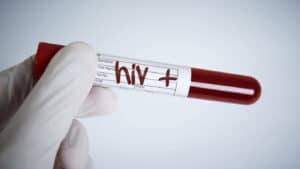Testes de rastreio ao VIH gratuitos e confidenciais esta sexta-feira em Guimarães