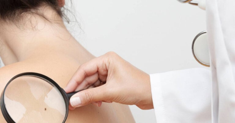 ULS Braga promove rastreios gratuitos de cancro de pele